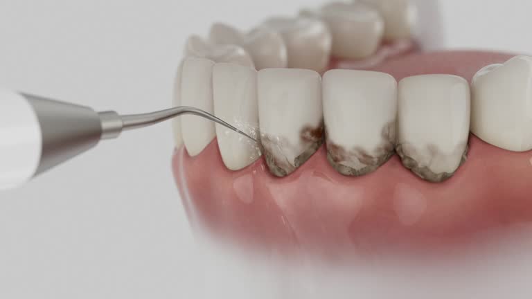 Trusted Teeth Cleaning And Checkup service in Wright City, MO - Dentist Open Now